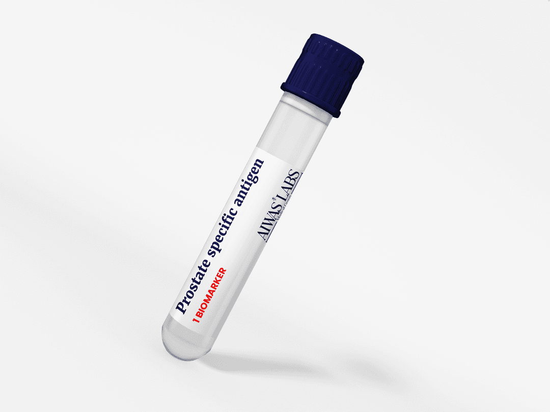 PSA – Prostate specific antigen