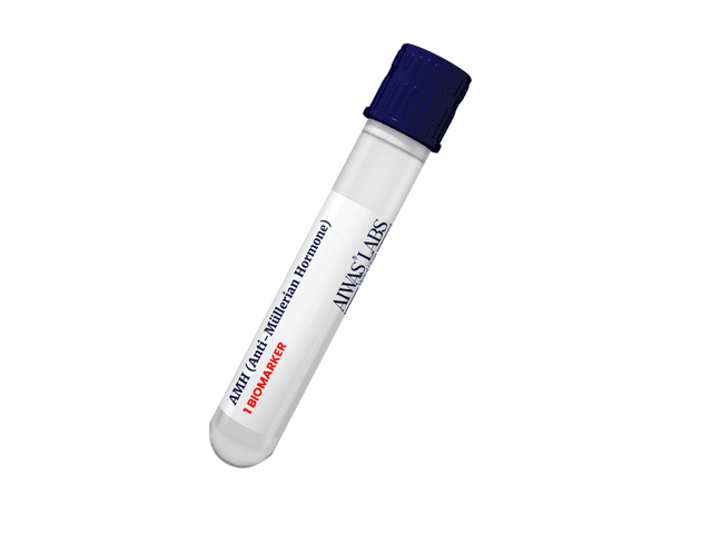 AMH (Anti-Müllerian Hormone)